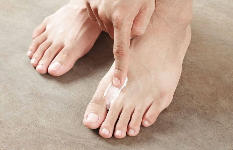 masť na liečbu plesní nechtov na nohách