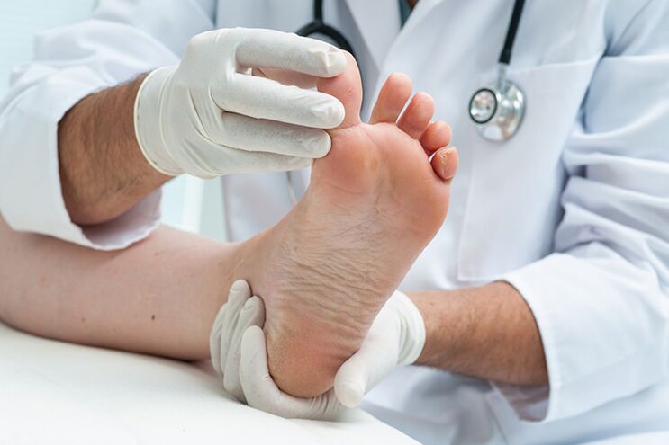 Dermatológ skúma nohy pacienta